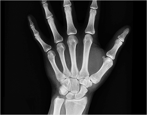 hands